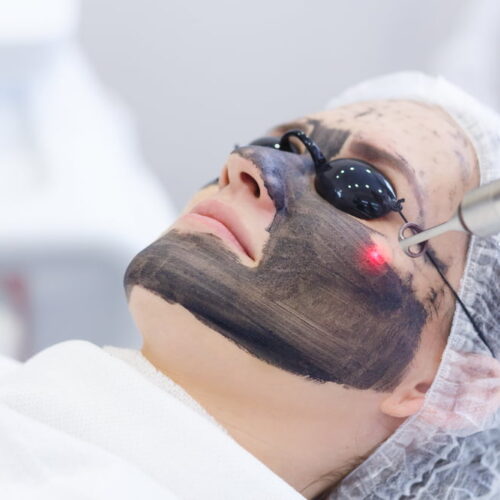 Hollywood Peel